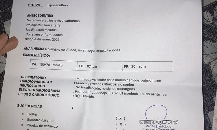 Cirugía lipoescultura con ritmo auricular bajo - 70472