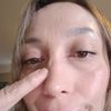 Retoque de la rinoplastia