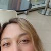 Retoque de la rinoplastia