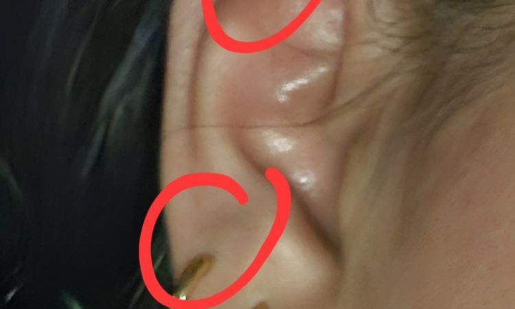 Cerrar agujeros de pircing de la nariz (nostril) y de mis 2 orejas - 83054