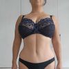 Línea en abdomen, post abdominoplastía
