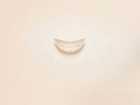 Implantes faciales Sebbin Implantes faciales Sebbin