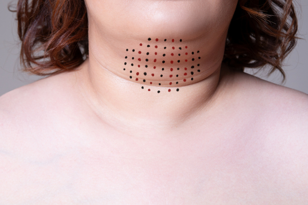 Mujer con marcas en el cuello
