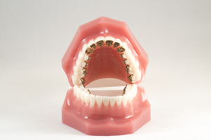 corregir la posición dental