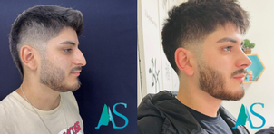 Primera cita de la cirugía