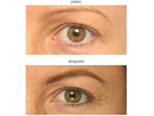 antes y después de micropigmentación