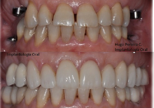 ¿Cuáles son los principales resultados de esta intervención?