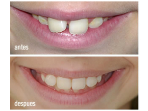 Resultados de odontopediatría