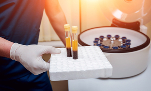 Plasma rico en plaquetas