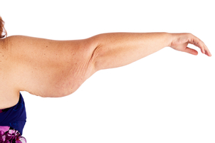 ¿Cómo saber si soy candidato para una braquioplastía?