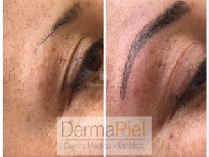 antes y después de microblading
