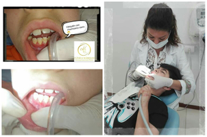 limpieza dental en chile