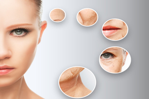 ¿Qué son los hilos tensores?