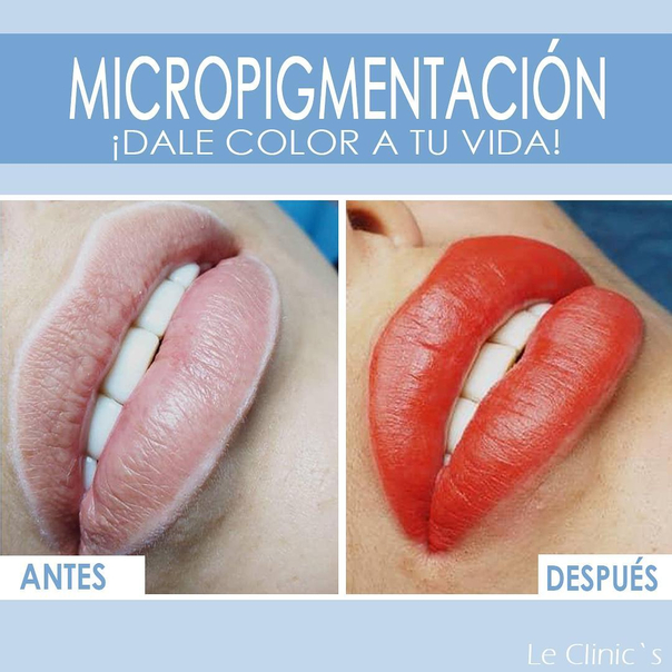 antes y después de micropigmentación 