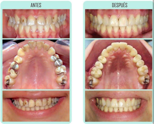 trabajo de endodoncia
