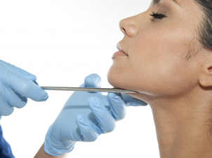 Qué es el aumento de pómulos