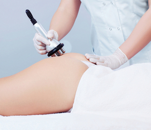 Aplicación carboxiterapia