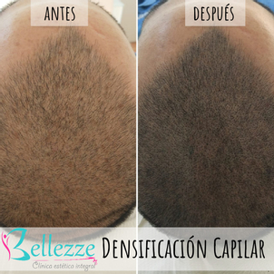 antes y después micropigmentación