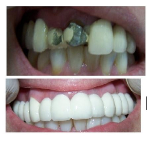 ¿Cuáles son los principales resultados?