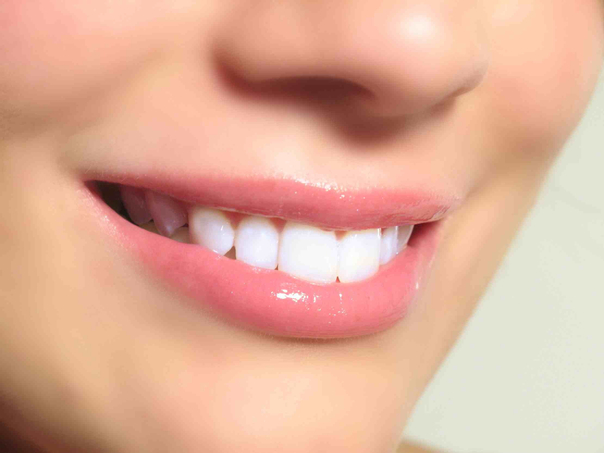 ¿Cuáles son las principales ventajas de un tratamiento de prótesis dentales?