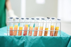Lipofilling