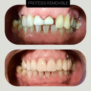 ¿Cómo es la primera visita al odontólogo?