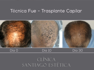 Imagen Clínica Santiago Estética