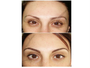 antes y después micropigmentación