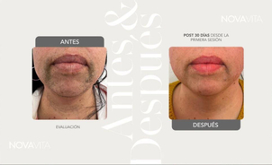 Clínica de depilación láser