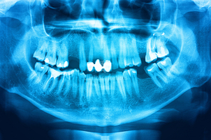 ¿Este tratamiento tiene complicaciones o contraindicaciones?