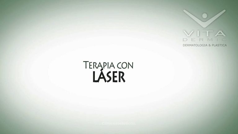 Tratamientos con láser en Clínica Vitadermic