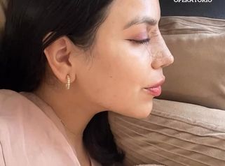 Rinoplastia Ultrasonica - Dra. Angélica Sifontes Muñoz