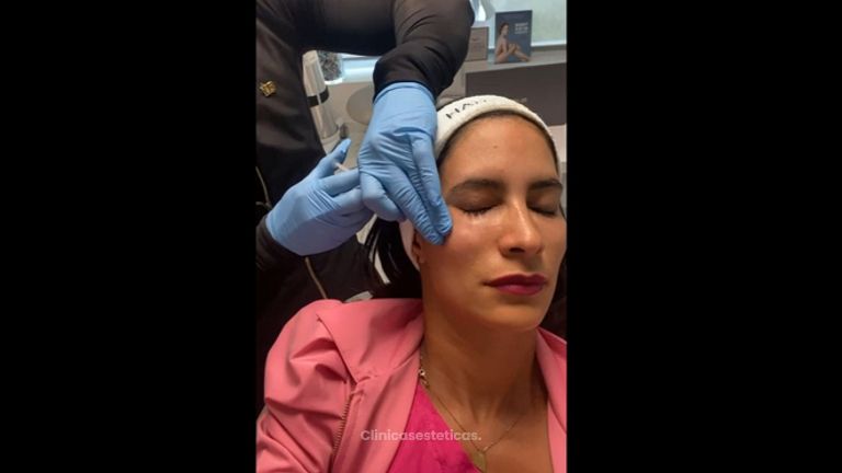 Rejuvenecimiento facial - Clínica Dra. Kelly Gulfo