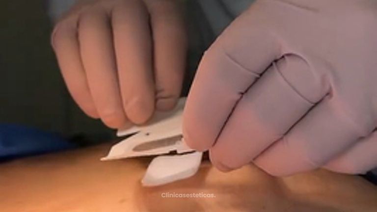 LifeChip Reposición Hormonal - Clinica Bendov