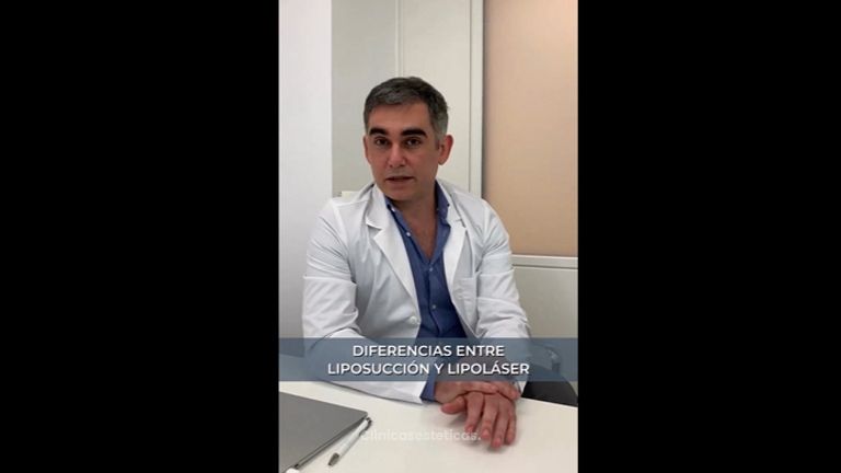 Diferencia entre Liposucción y Lipoláser - Dr. Nadir Carda