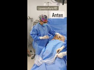 Liposucción - Cirugía Plástica Dieppa