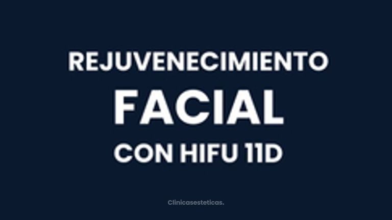 HIFU - IDENTAL