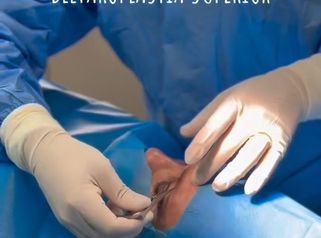 Blefaroplastia - Dr. Marcelo Fonseca Canteros