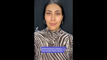 Armonización facial - Medicina Estética Integral MD