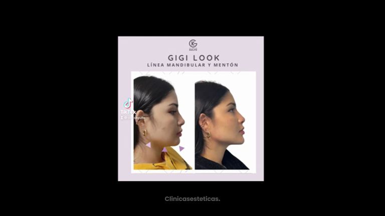 Gigi Look - Clínica Dra. Kelly Gulfo