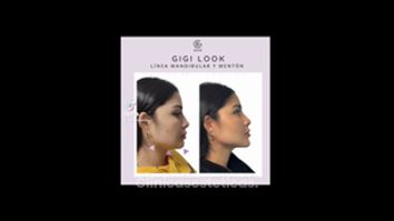 Gigi Look - Clínica Dra. Kelly Gulfo