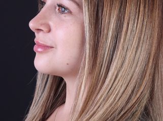 Full Face - Dra. Evelyn Schneider M.