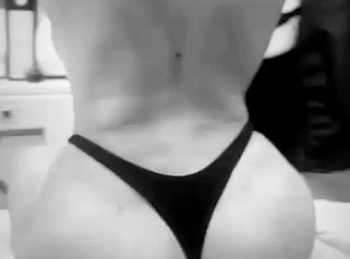 Lipoescultura más transferencia de grasa a glúteos - Dr. Guillermo Santana