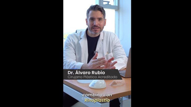 Rinoplastia - Dr. Alvaro Rubio González
