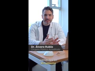 Rinoplastia - Dr. Alvaro Rubio González
