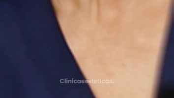 Blefaroplastia - Ceomédica