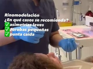 Rinomodelación con ácido hialurónico - Dr. Julio Vallejos