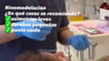 Rinomodelación con ácido hialurónico - Dr. Julio Vallejos