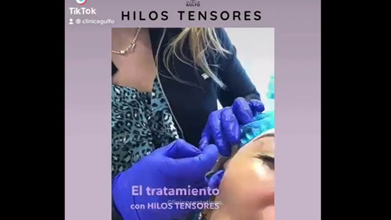 Hilos tensores - Clínica Dra. Kelly Gulfo