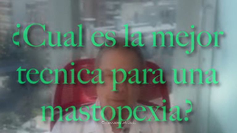 ¿Cual es la mejor tecnica para una mastopexia? - Dr. Vicente Sánchez Liberona